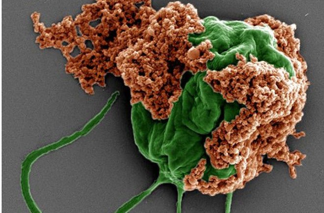 Microrobots Made Of Algae Carry Chemo Directly To Lung Tumors